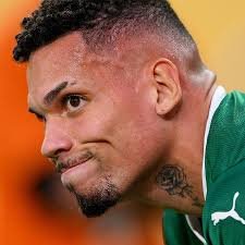 temp_image_1751795063.110929 Paulinho do Palmeiras: Cirurgia na Perna Confirma Atacante Fora da Temporada 2025