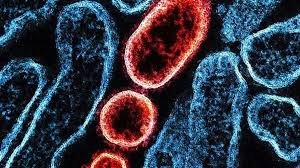 temp_image_1770891814.219472 Doença Nipah: O Que Você Precisa Saber Sobre o Vírus Mortal