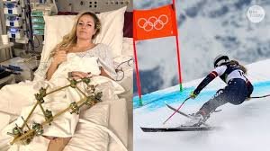 temp_image_1772850860.297293 Nuggets x Knicks: Josh Hart Joga Hoje Apesar de Dúvidas com a Costas!