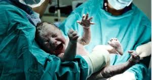 temp_image_1777377194.433266 Podemos criminalizar a obstetrícia? CFM alerta para riscos graves a mães e bebês