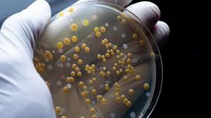 temp_image_1778544305.168708 Superbactéria em Porto Alegre: UFRGS Alerta para Presença de Bactéria Multirresistente em Águas da Capital